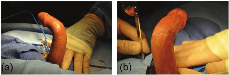 zakrivljen penis slika